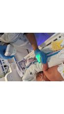 Image for George Eliot Hospital’s Smallest Patients Benefit from Successful Neonatal Vein Finder Fundraising Campaign